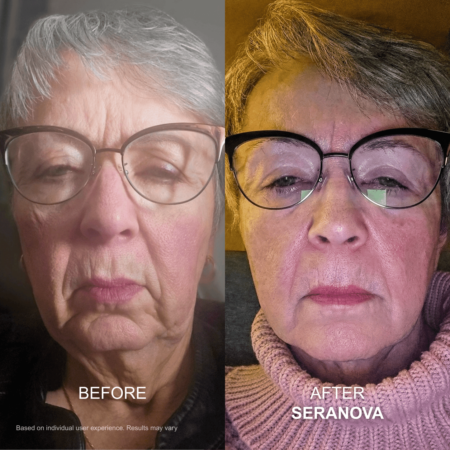 The Micro Infusion System