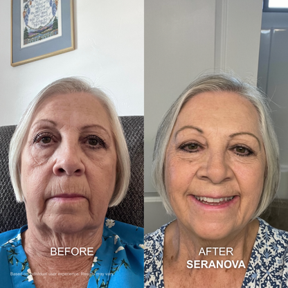 The Micro Infusion System