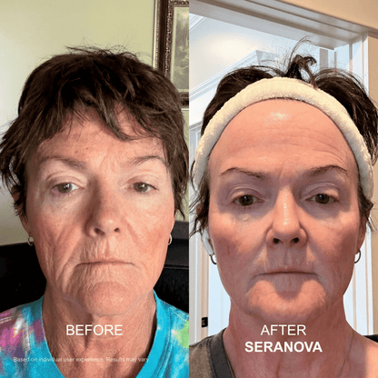 The Micro Infusion System